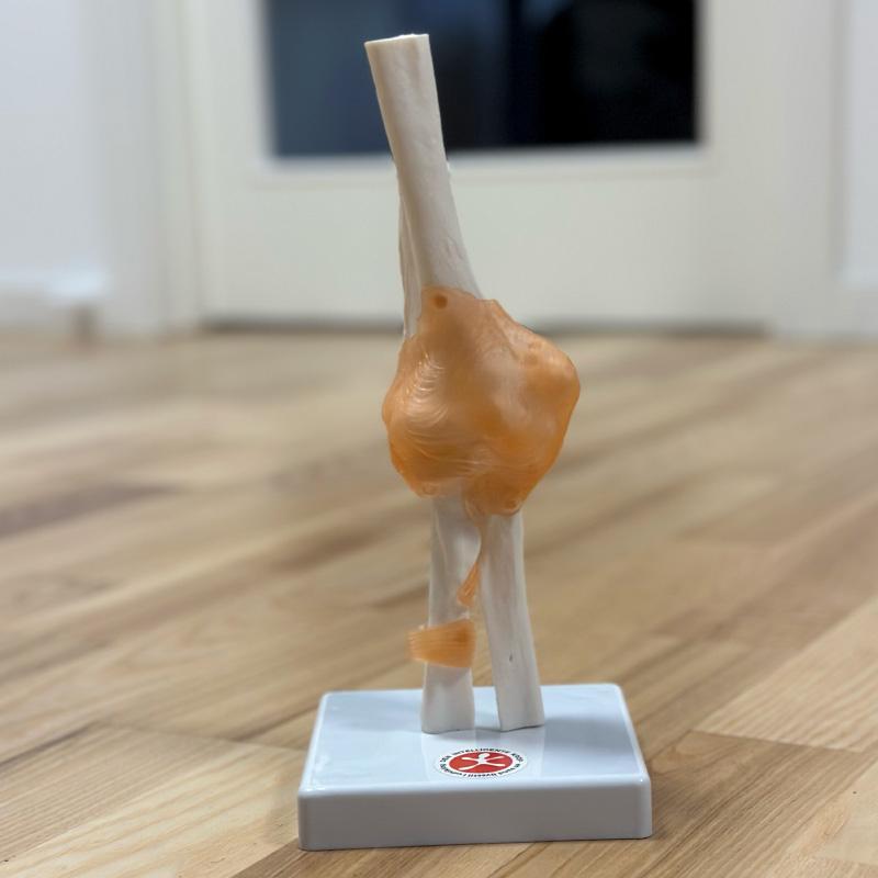 Albueled  Fuld Størrelse
